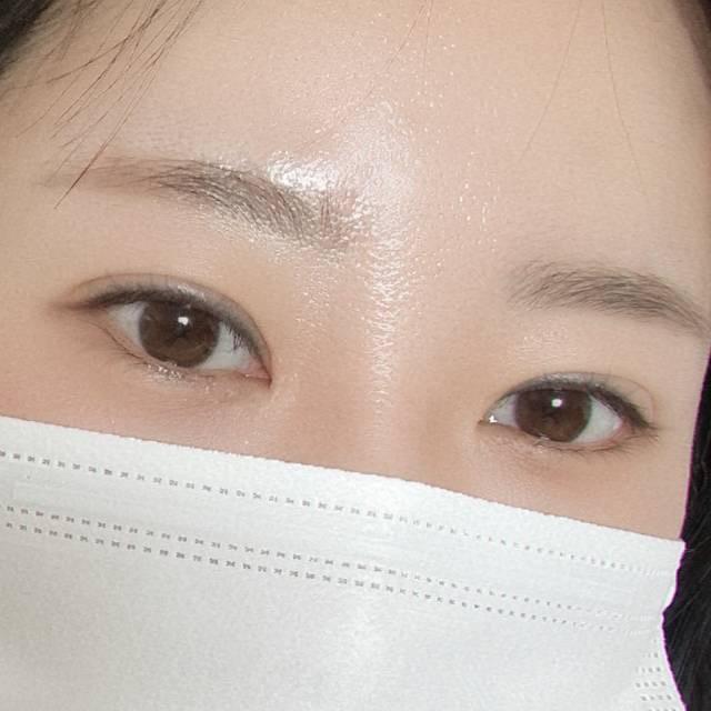 後
