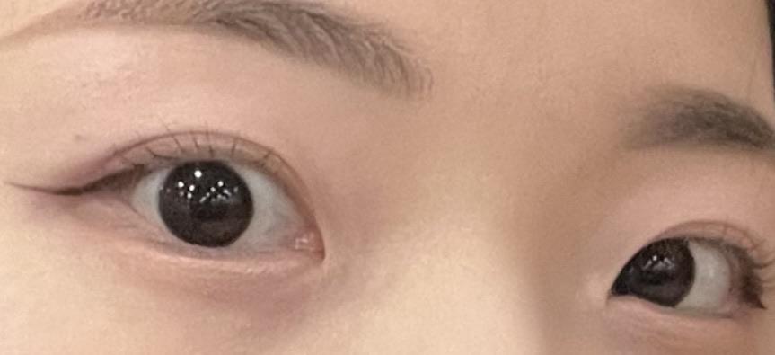 後