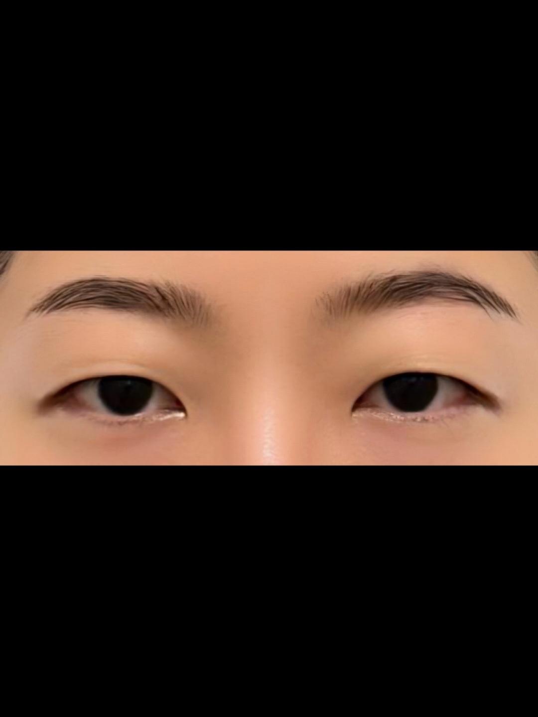 後