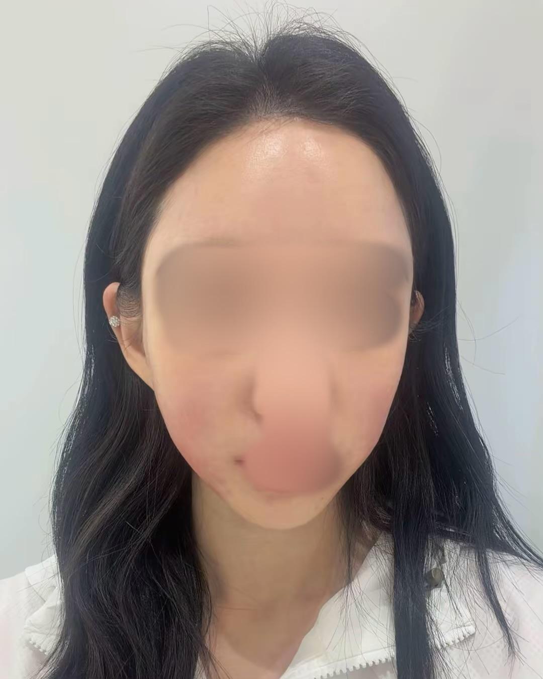 後