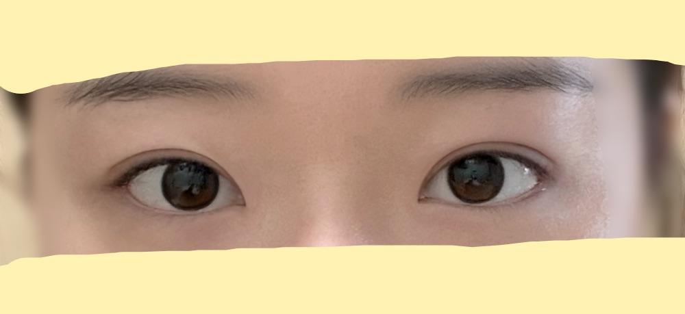 後