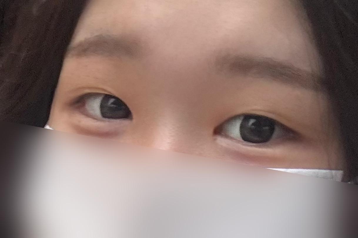 後