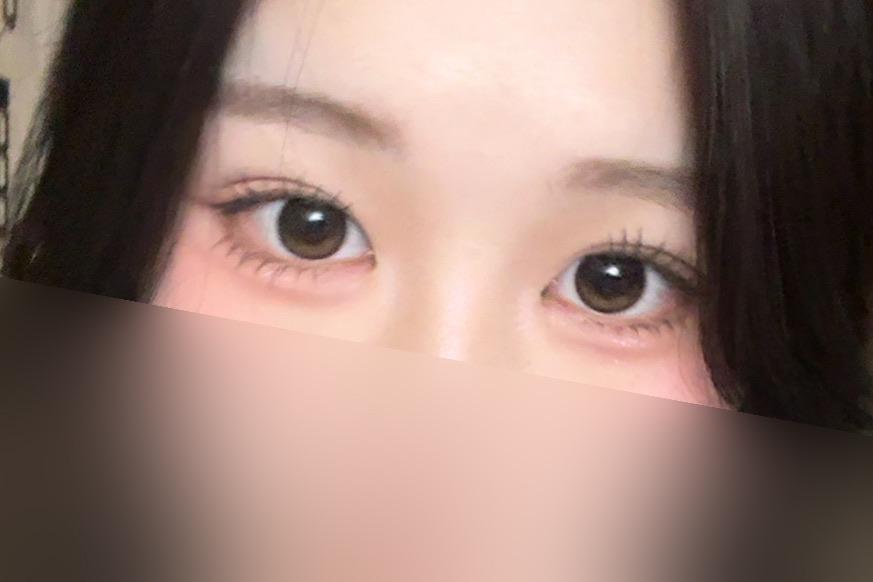 後
