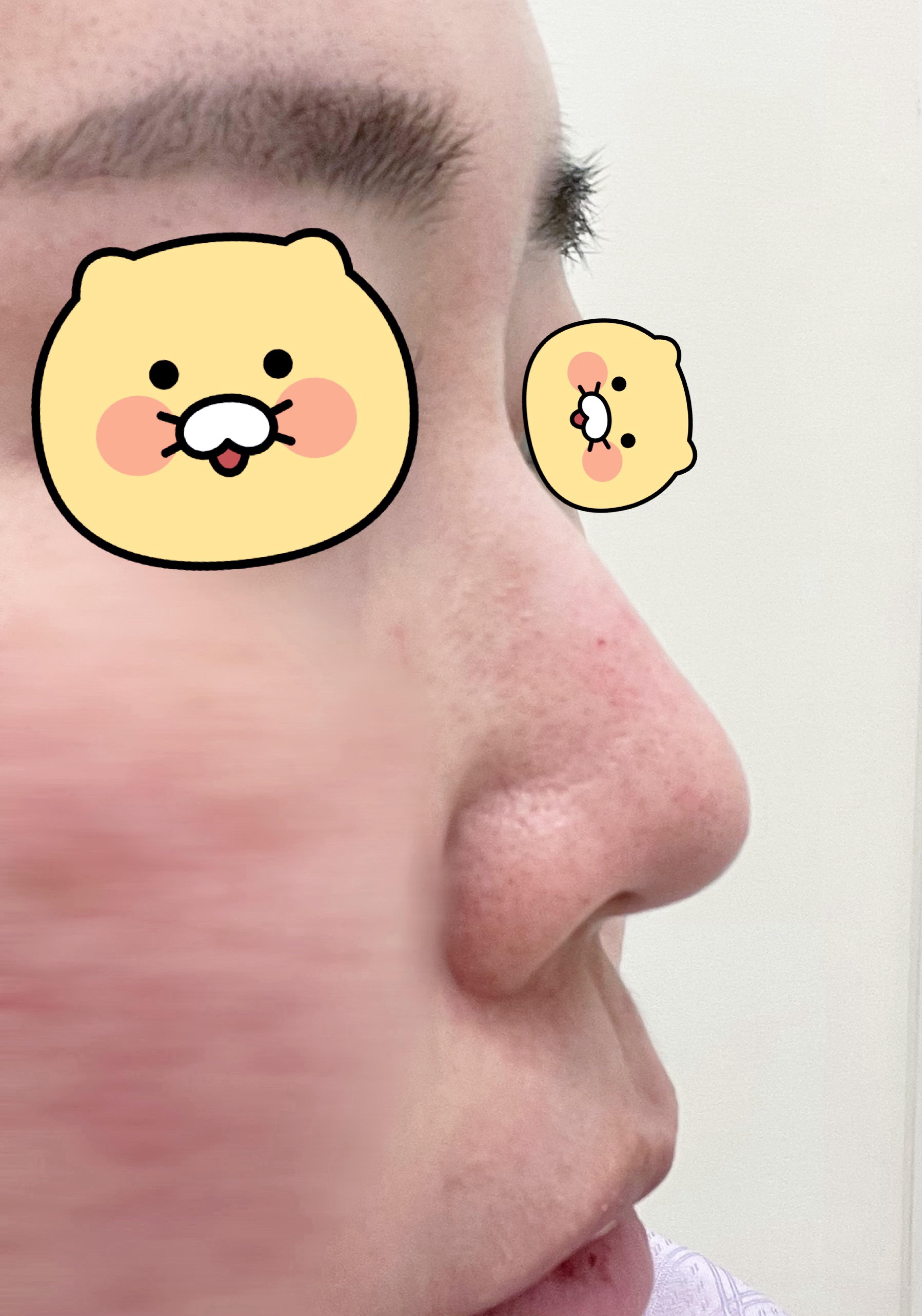 後
