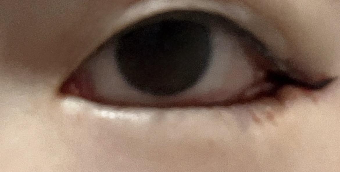 前
