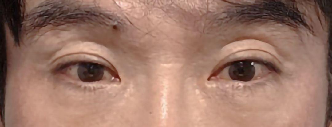 前