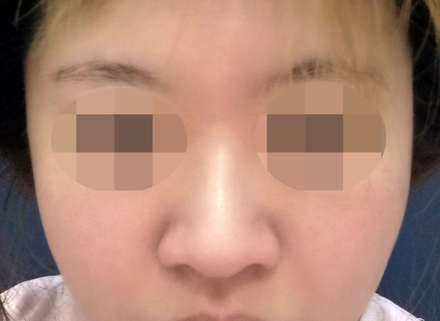 後