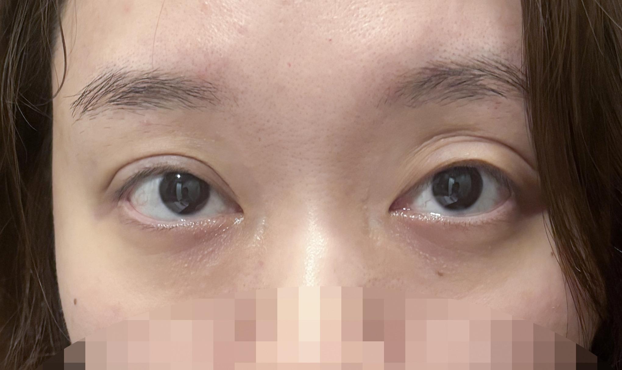 後
