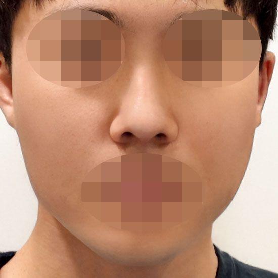 後
