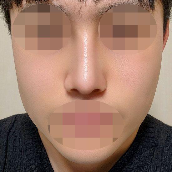 後
