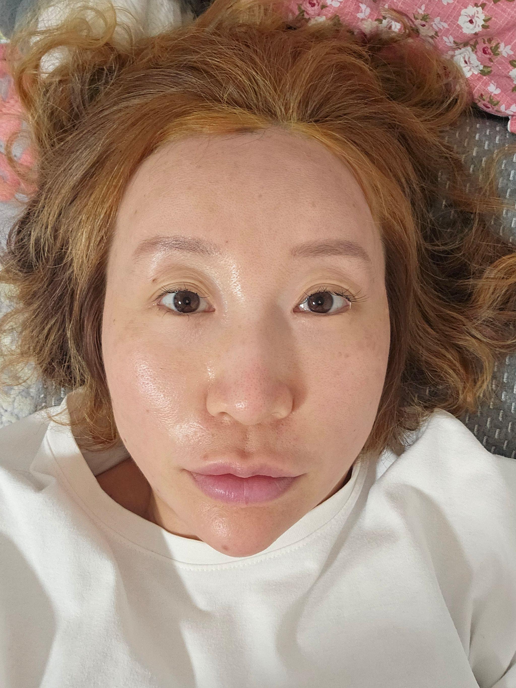 後