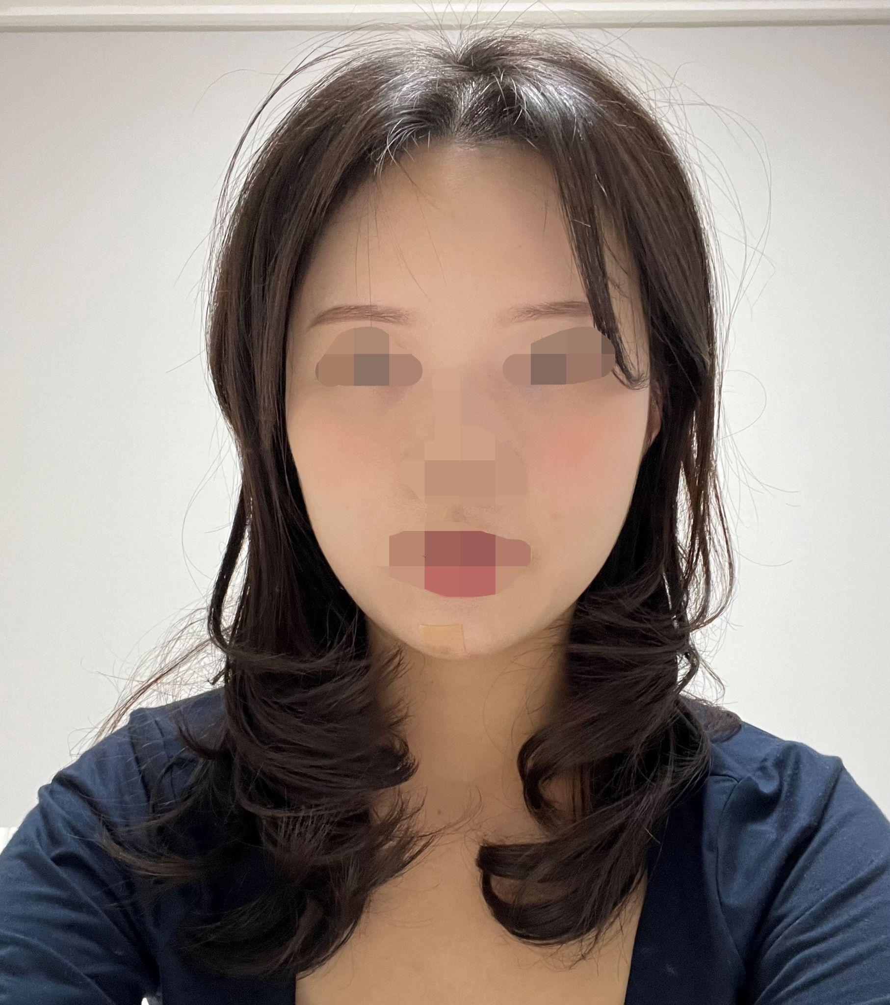 後