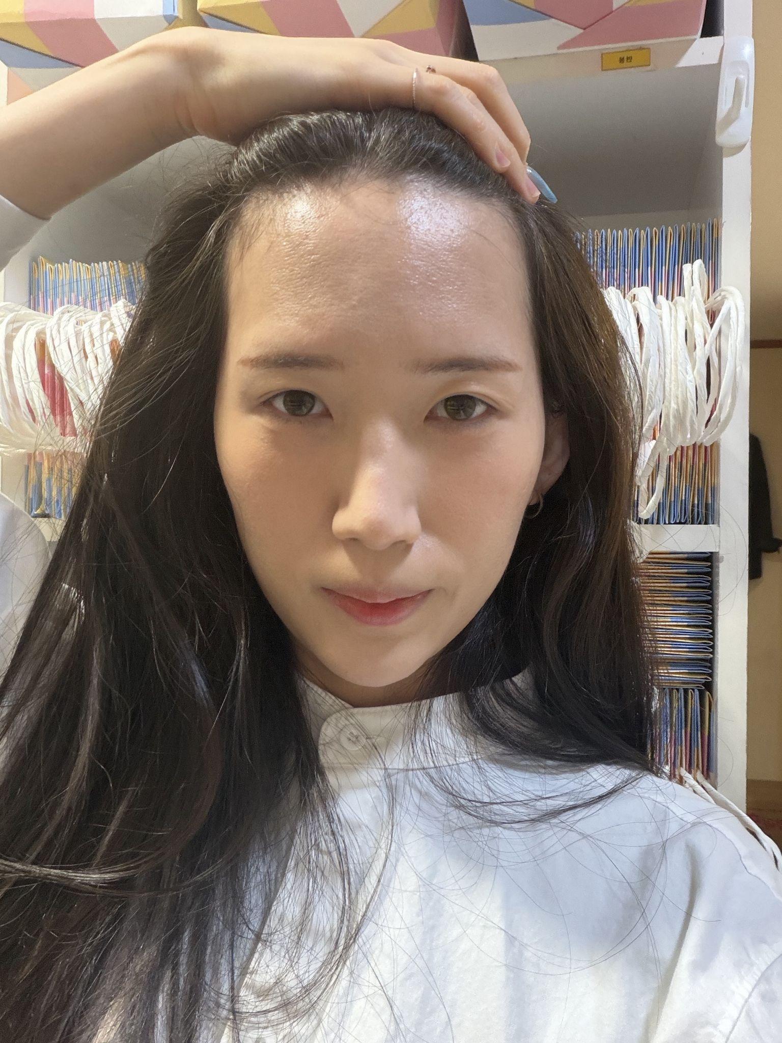 後