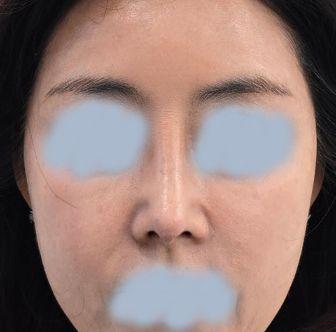 後