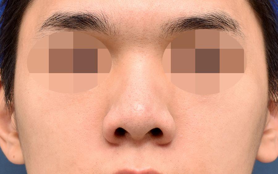 後