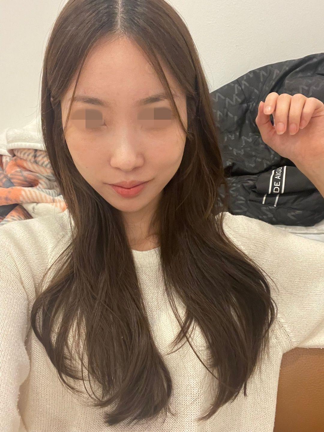 後