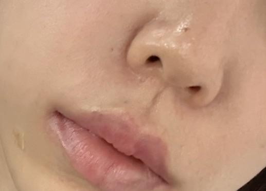 後