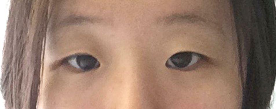 後