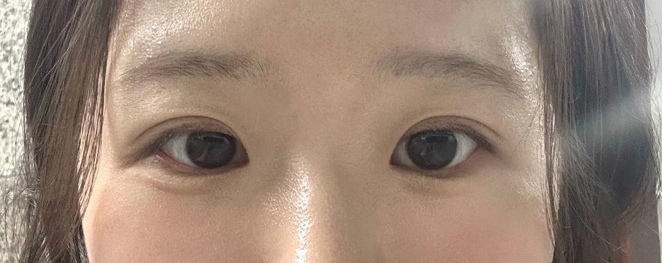 後