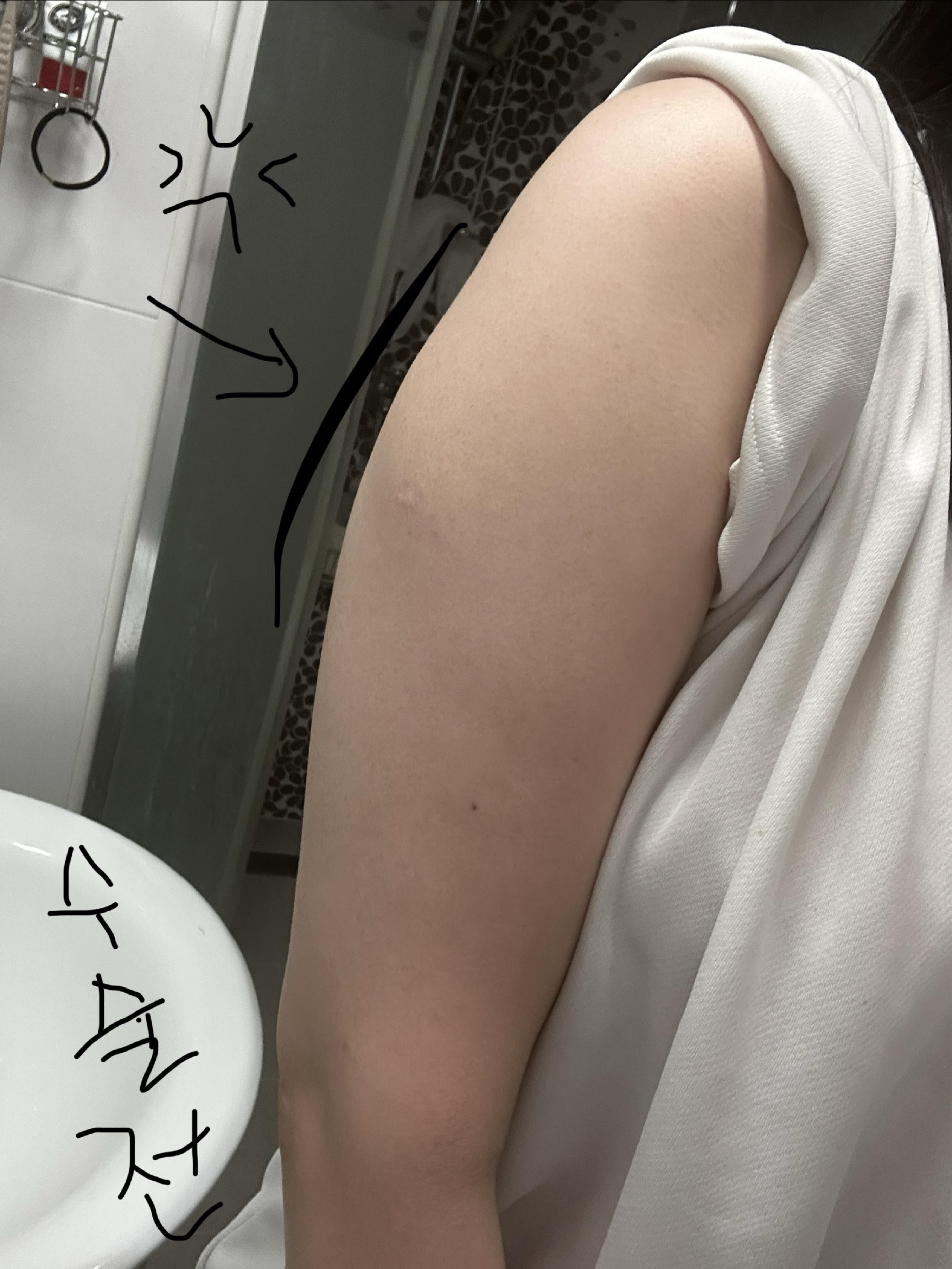 後