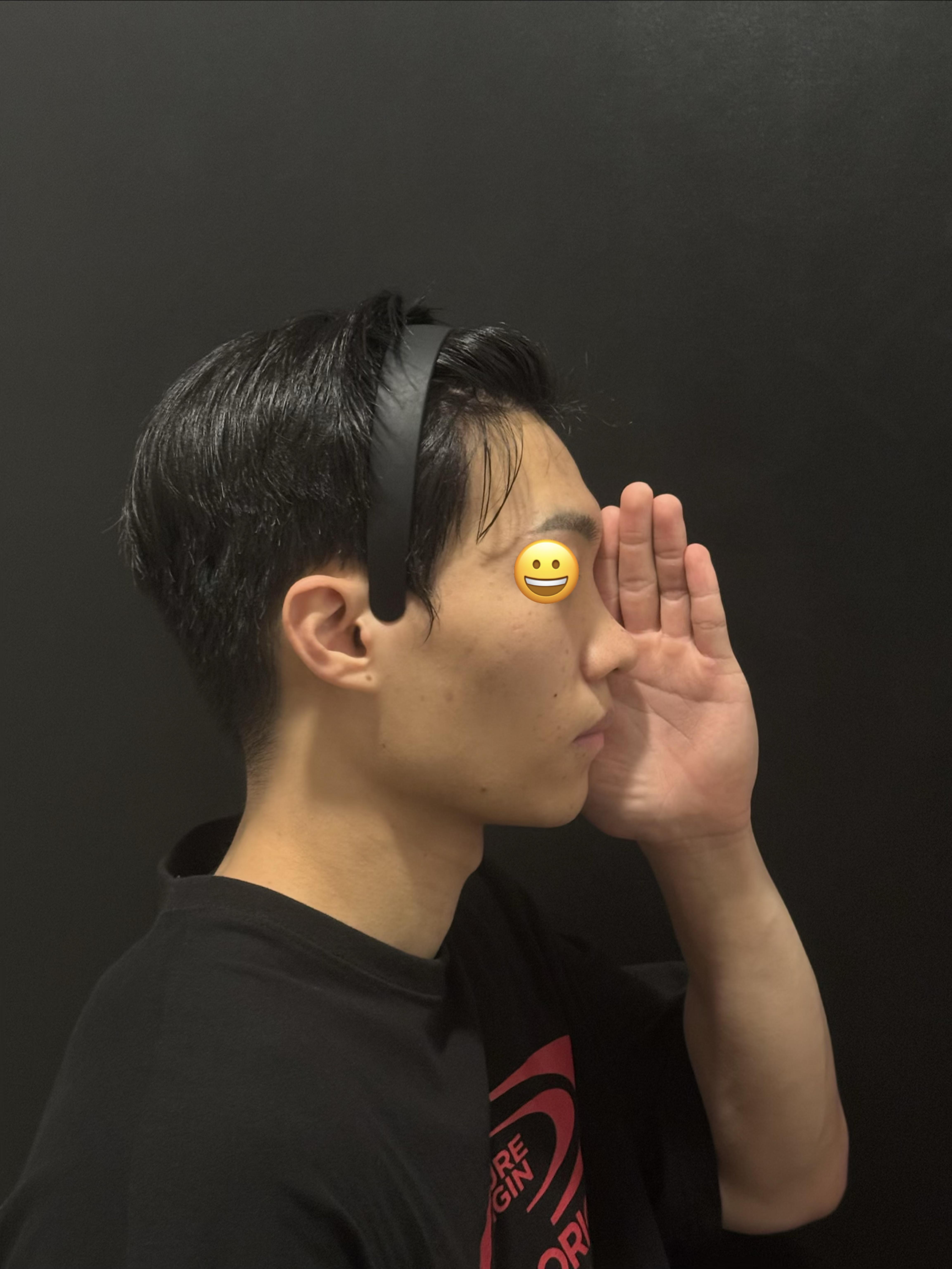 後