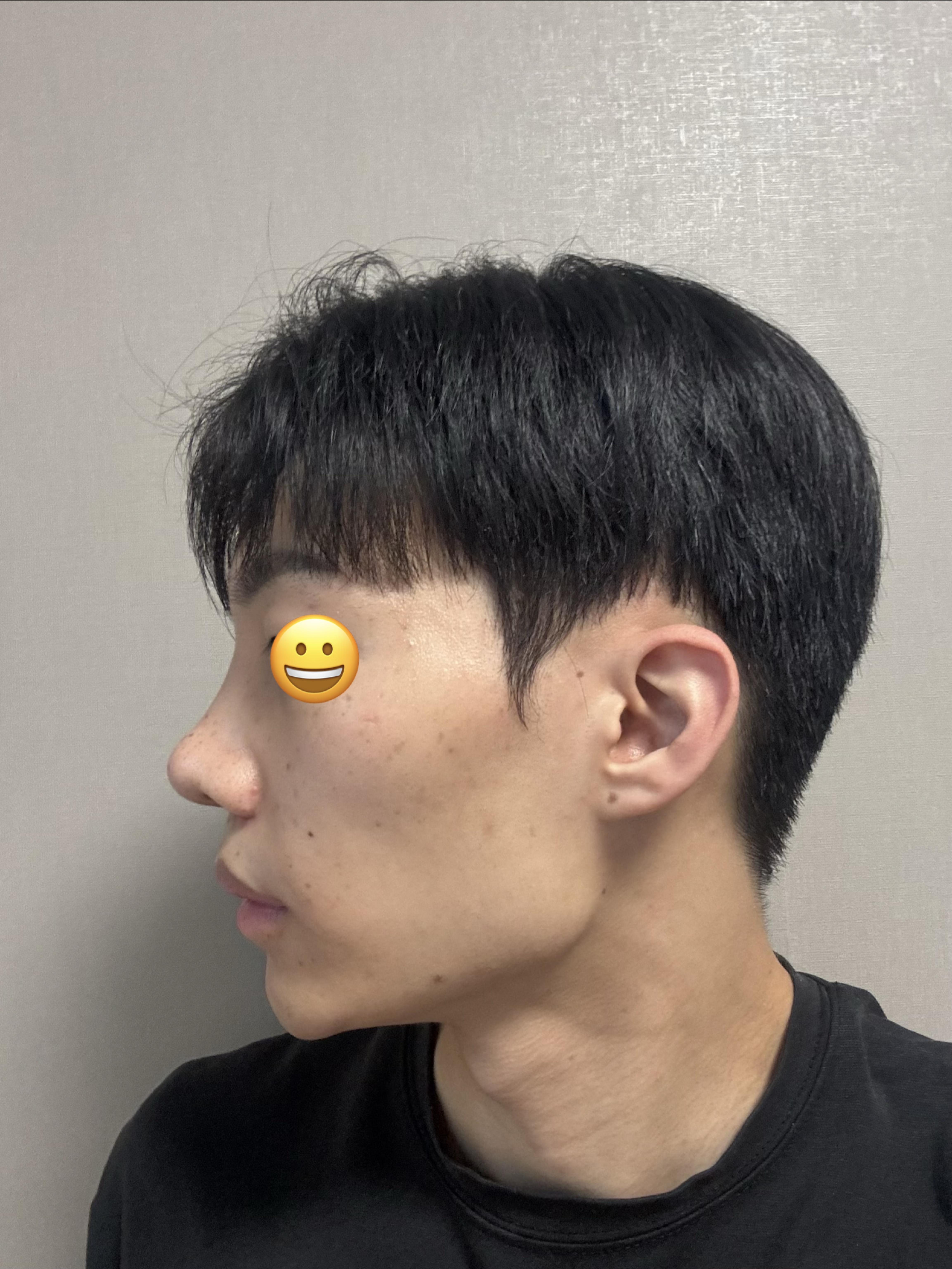 後