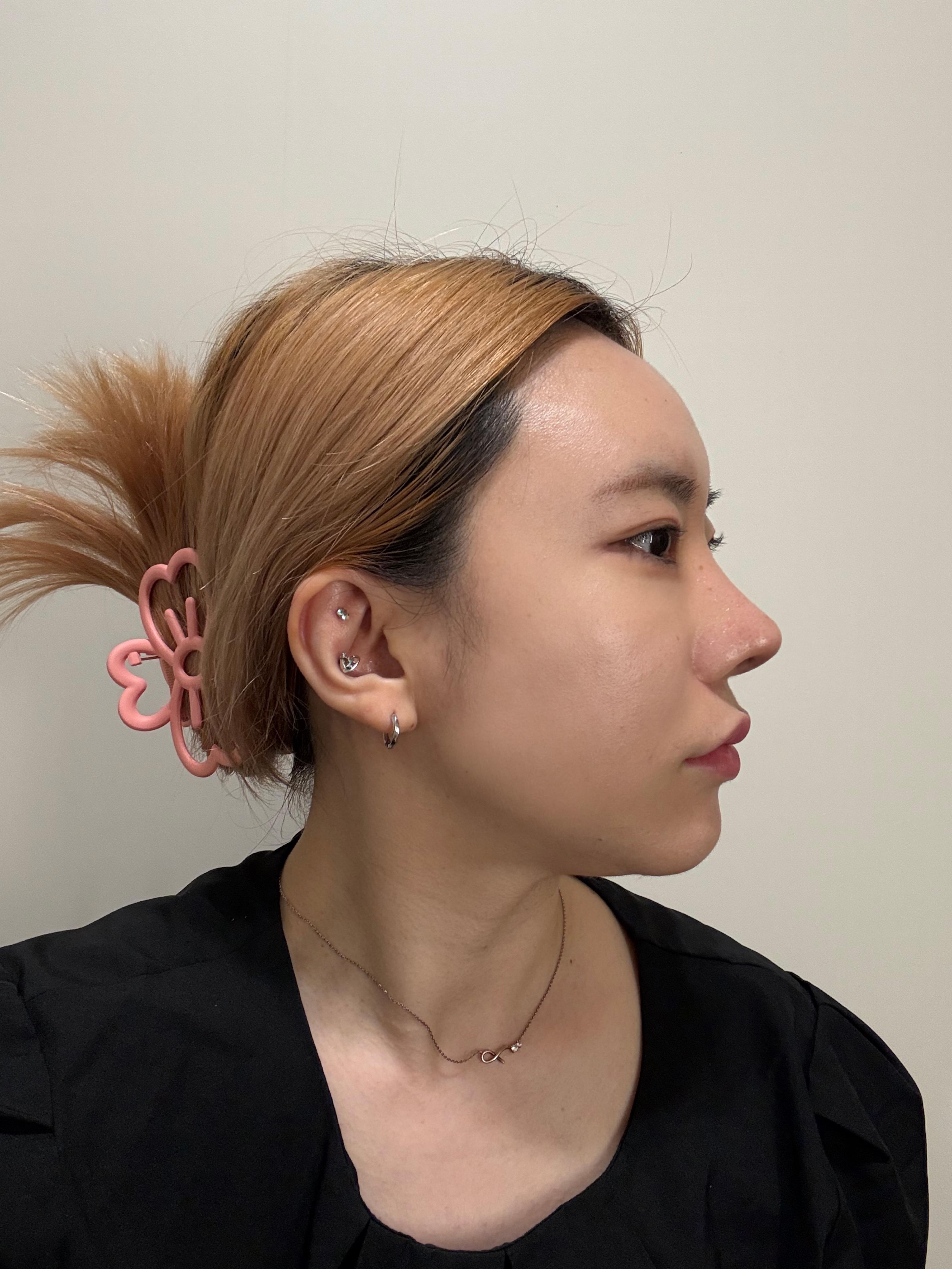 後
