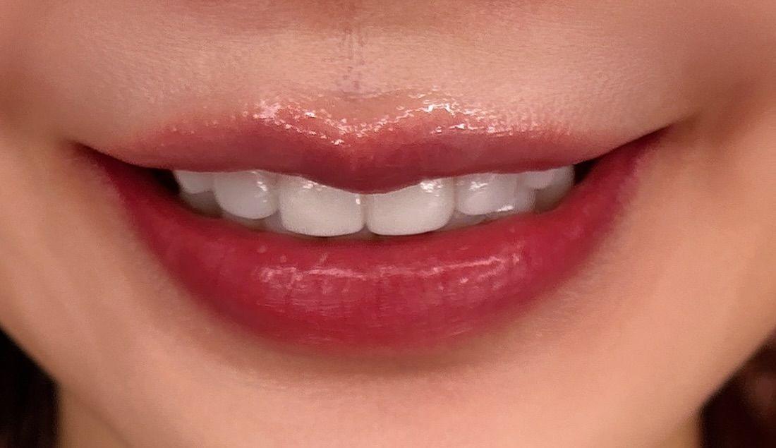 後