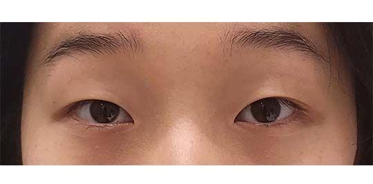 後