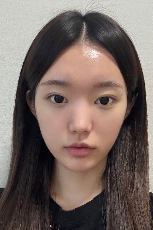 後