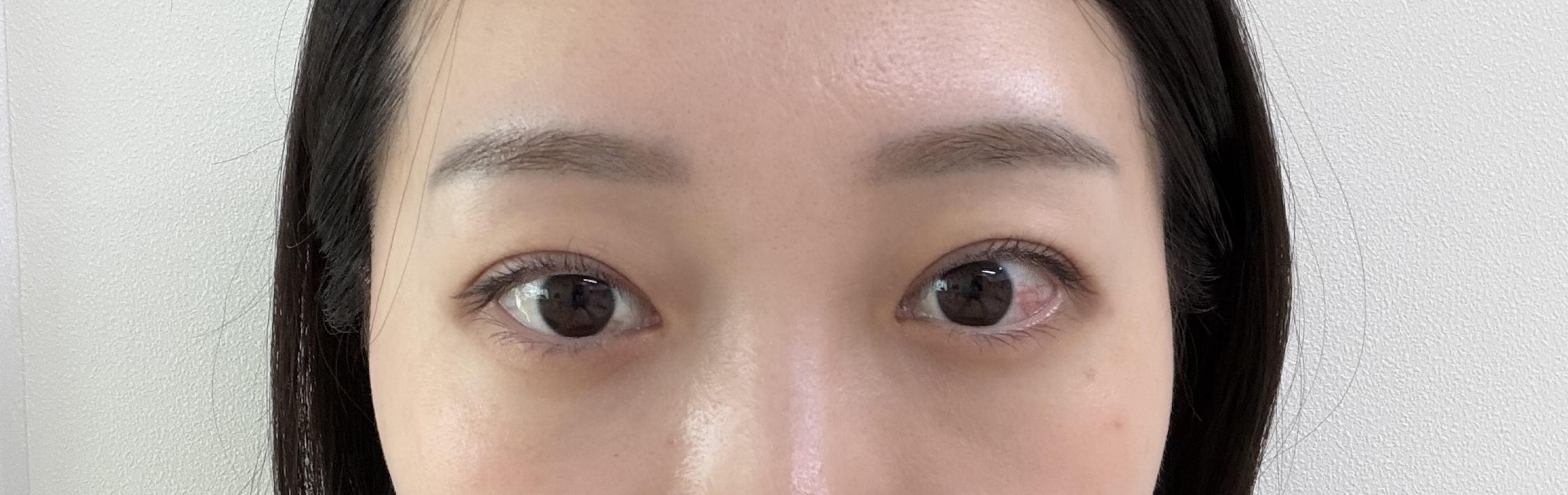 后