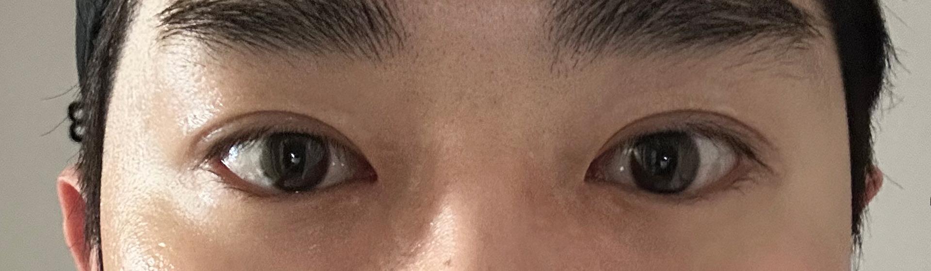 後