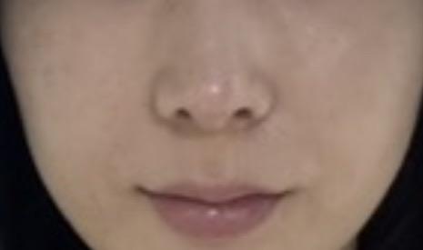 後