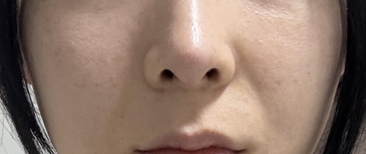 後