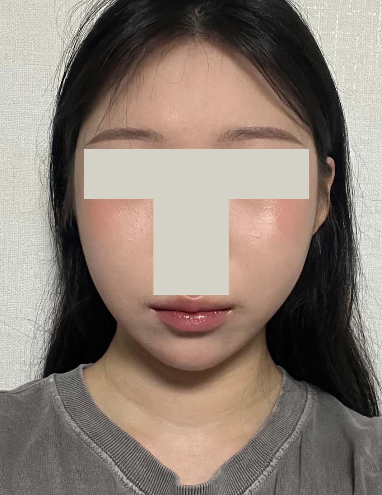 後