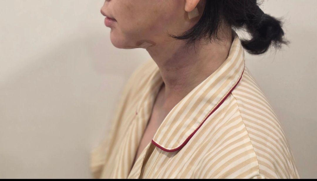 后