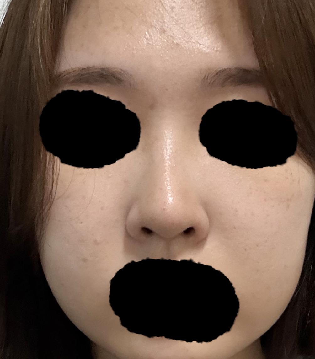 後
