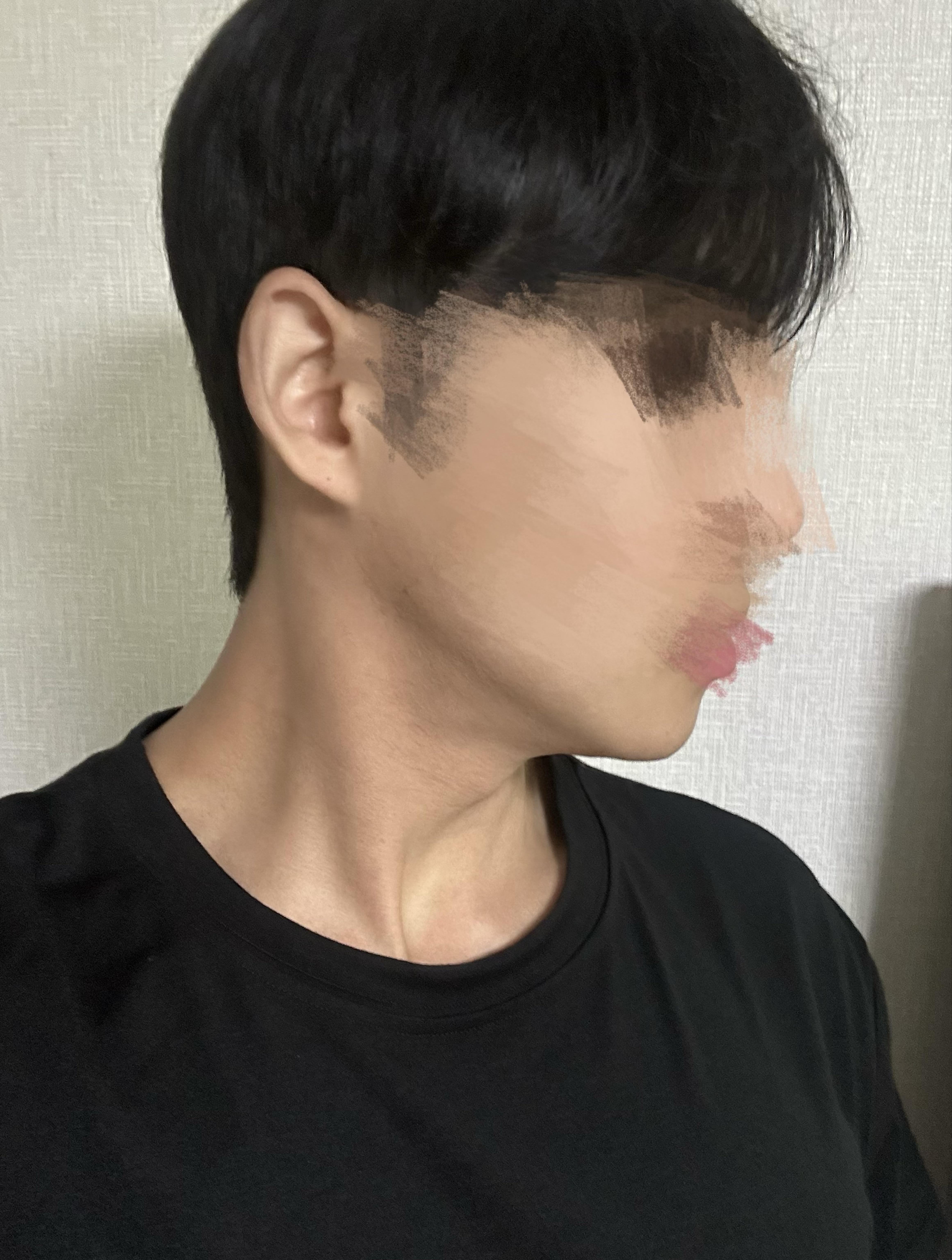 後