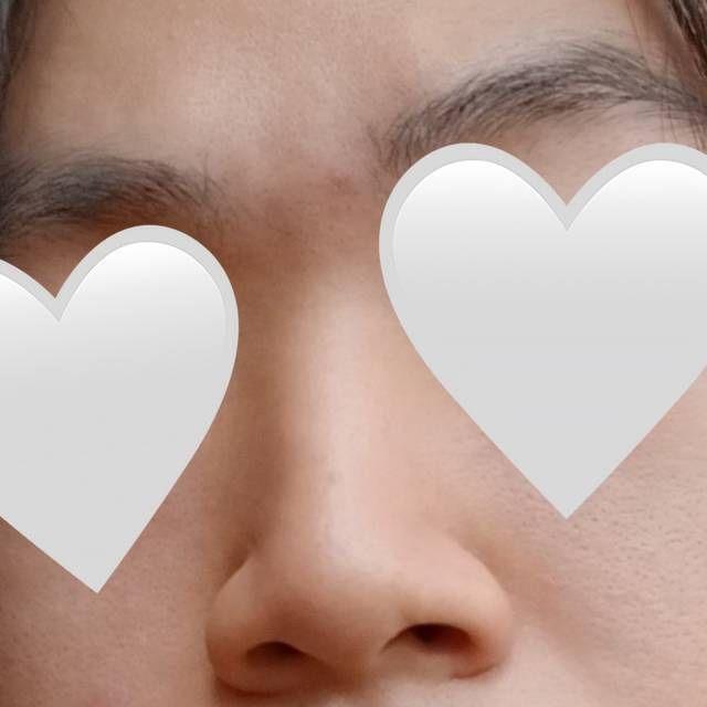 後
