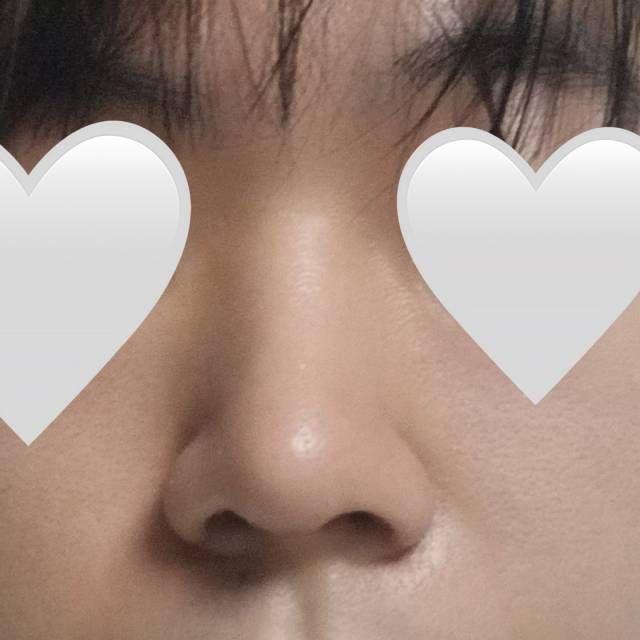 後