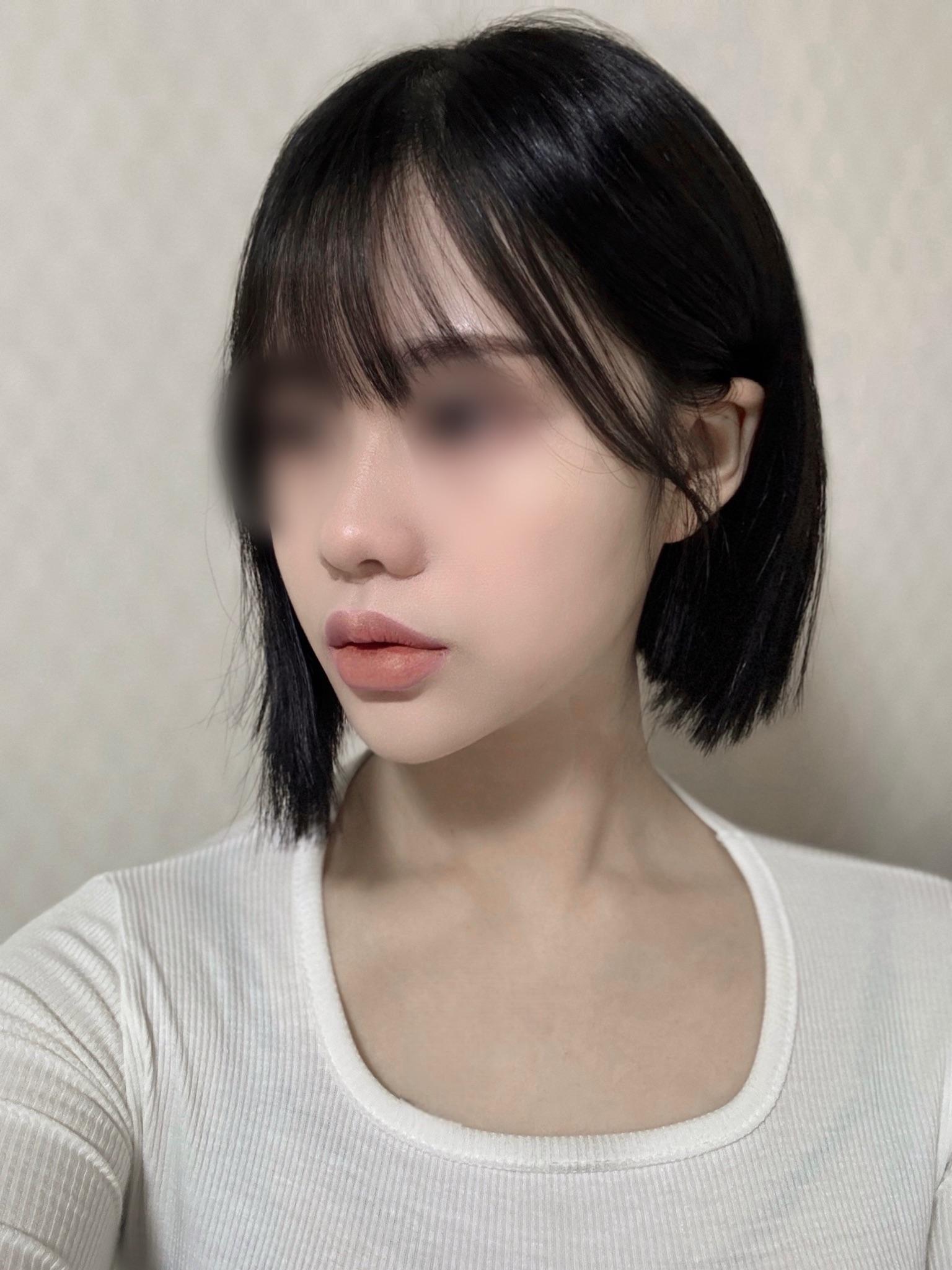 後