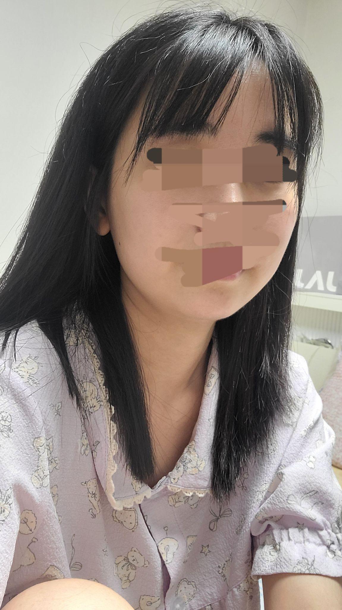 後