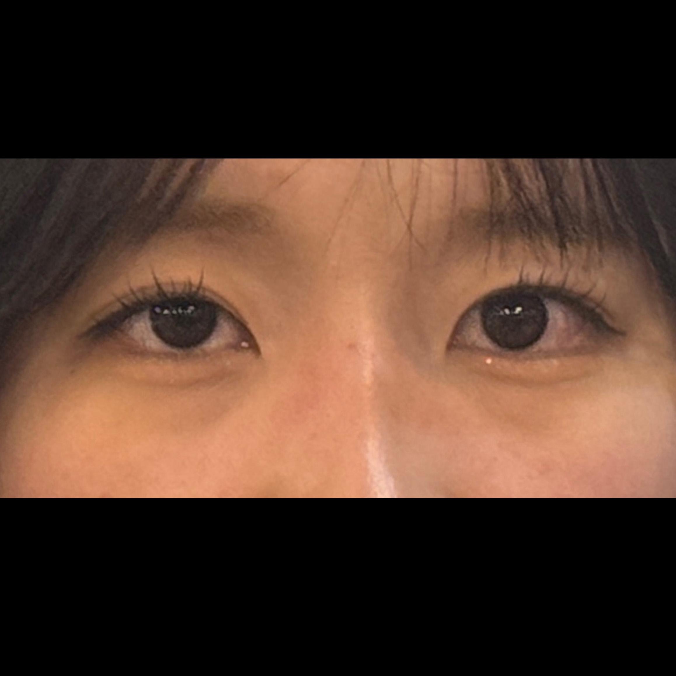 後