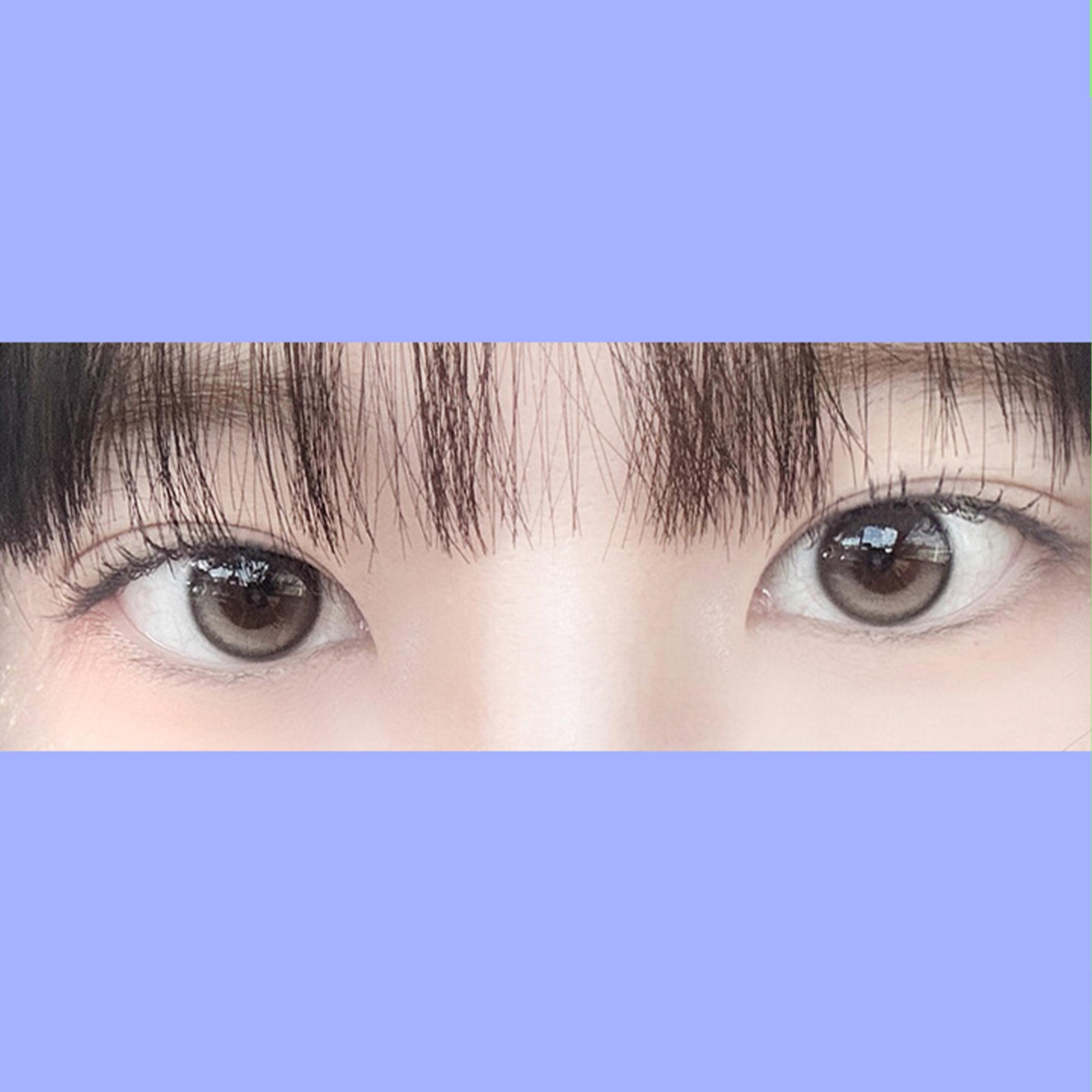 後