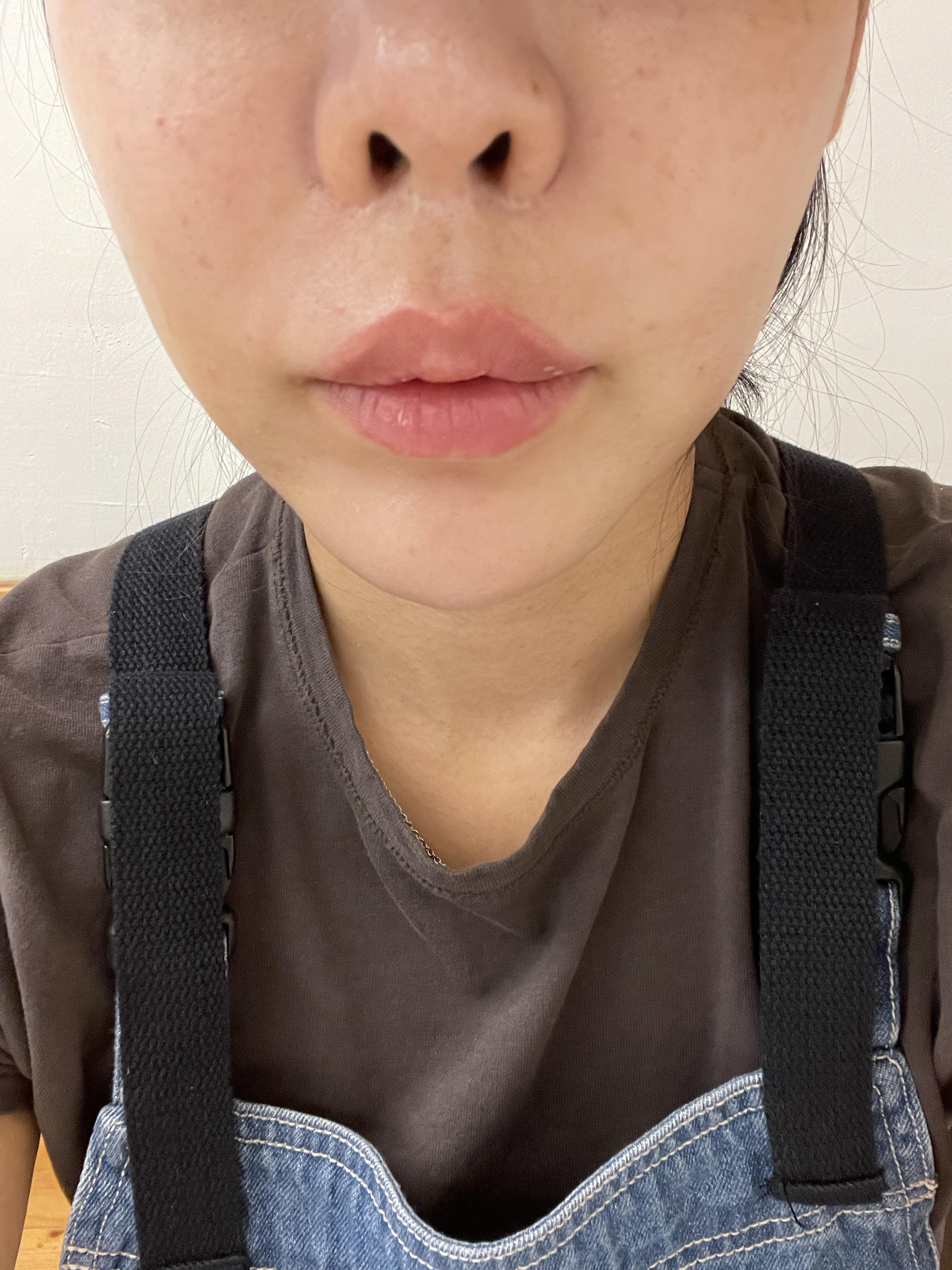 後