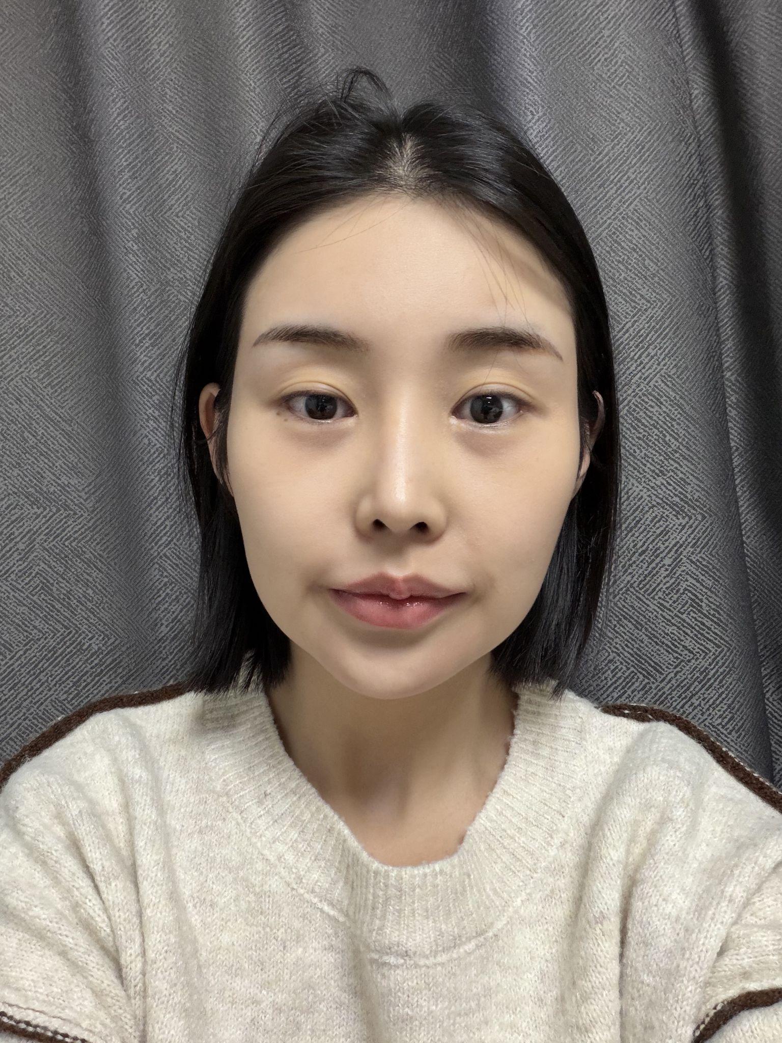 後