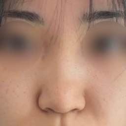 後