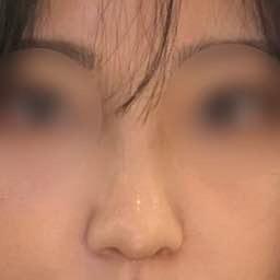 後