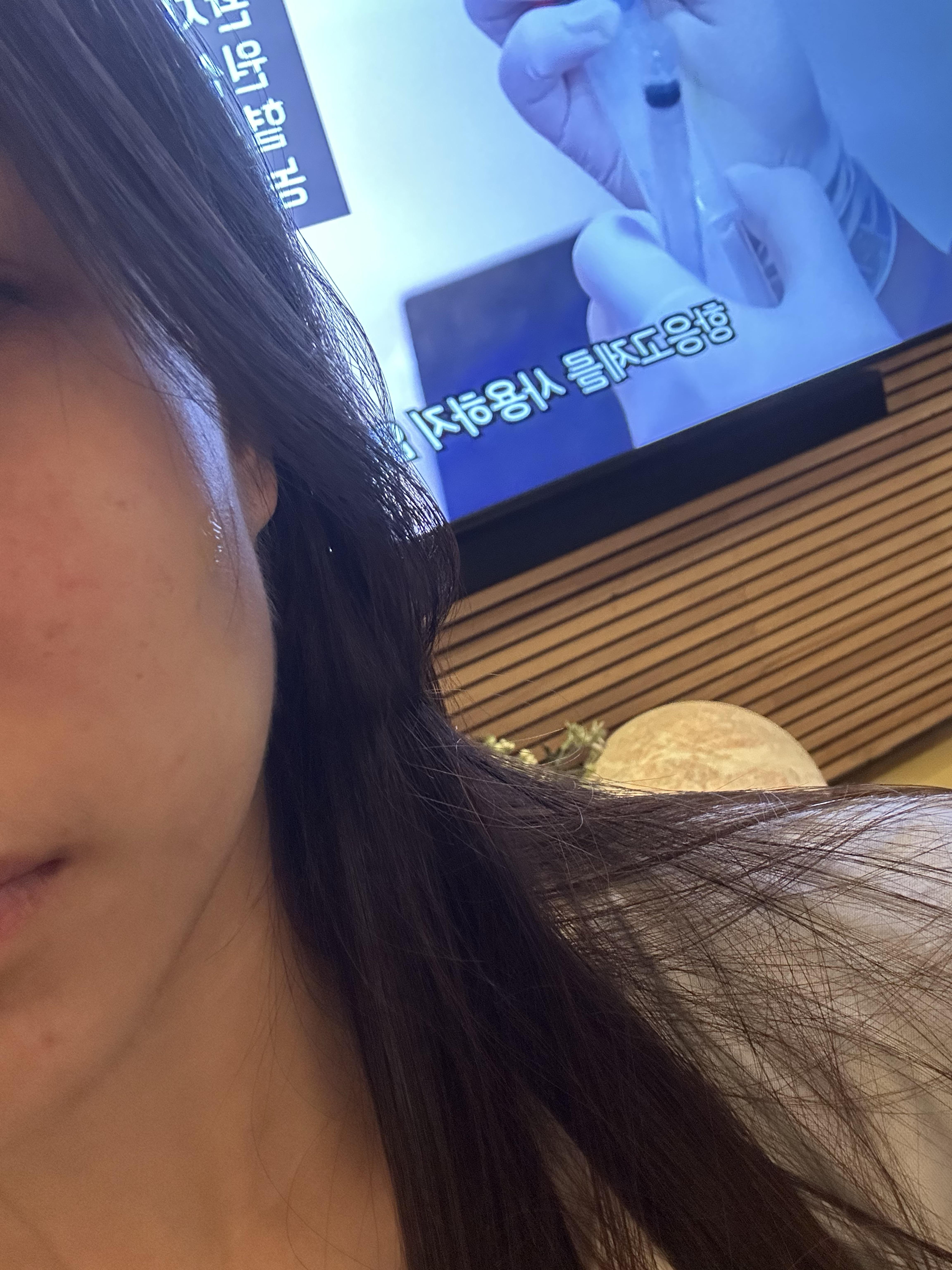 後