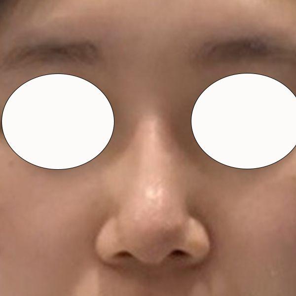 前